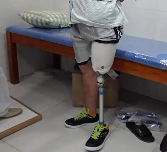 供应大腿假肢穿戴用假肢穿引套假肢易拉宝一拉得宜拉宝