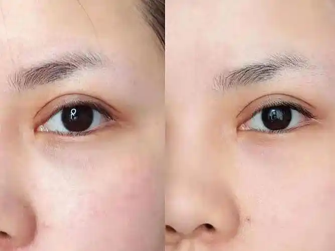 体验前变美诉求:改善皮肤粗糙,干燥.