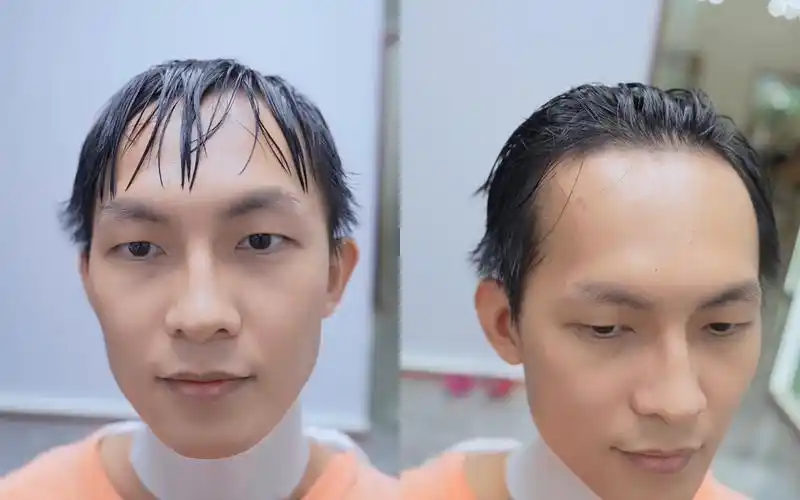 男生额头高头顶发量少,看下这个小哥做的发型,现场发型案例分享