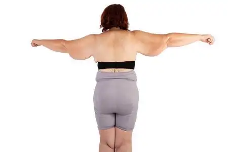 中年妇女下垂过度手臂皮肤极度减肥.