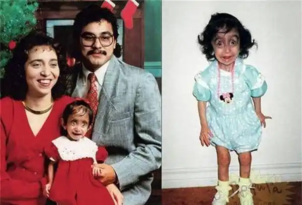 400万人咒她去死,这个被称为"全球最丑的女人",终于选择反击