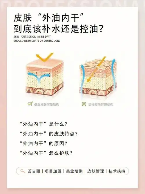 皮肤外油内干该补水还是控油7175