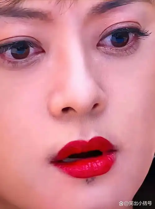 天呐,孙俪下巴上那颗黑痣竟然长毛了,这种黑痣长毛挺常见的,大家都叫