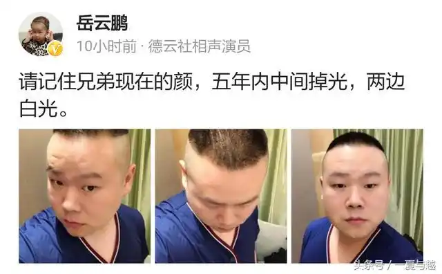 谢娜怀孕剪短发,岳云鹏坦言5年内变成秃头,网友:头发