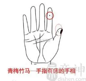 右手食指有痣