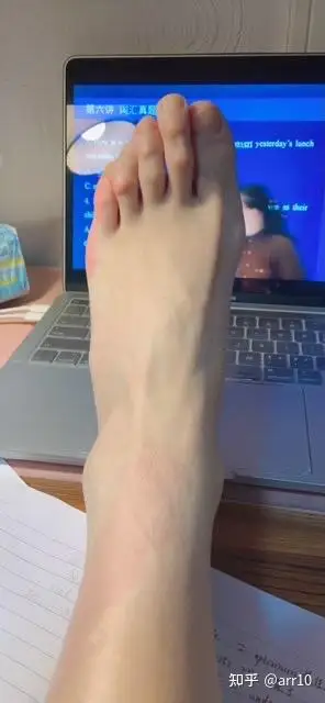 女友的希腊脚大家觉得那个好看