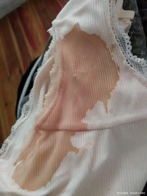 帮我看看怎么回事检查回来内裤就这样湿湿的