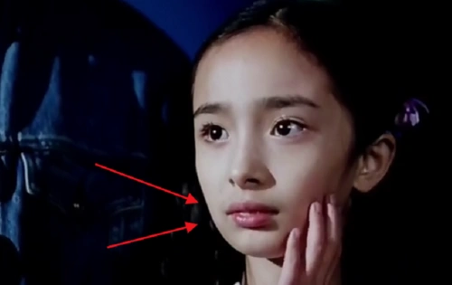 11岁杨幂竟是龅牙今却被质疑整容粉丝我大幂幂天生丽质