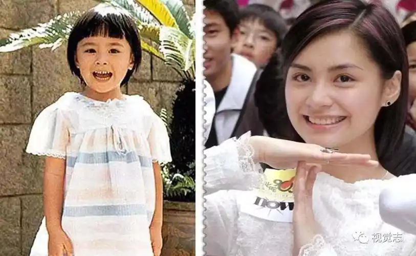 阿娇小时候是个蘑菇头的牙缝妹▽袁弘真的是和小时候一毛一样都没有变