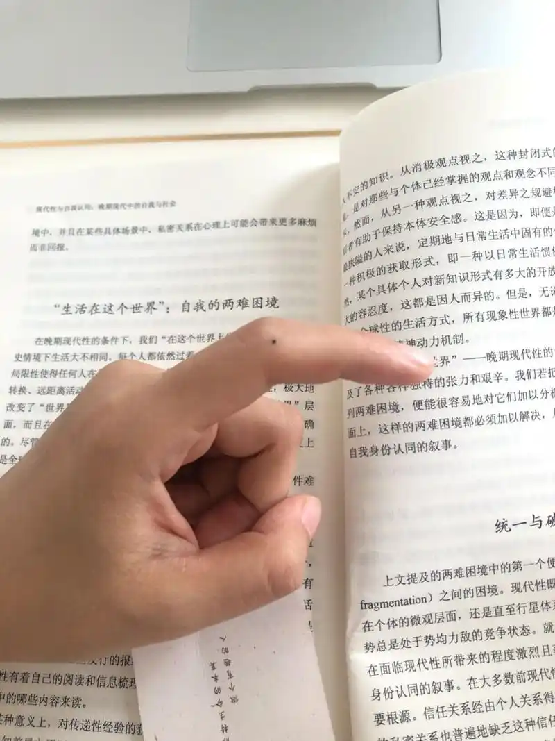 食指莫名长了一个黑色的痣 估计好几个月了!