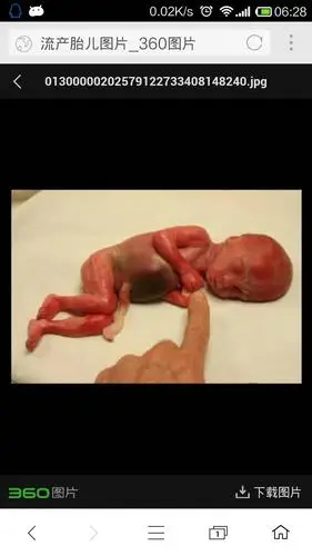 绍兴妇保院做引产需要证明吗?需要多少钱?