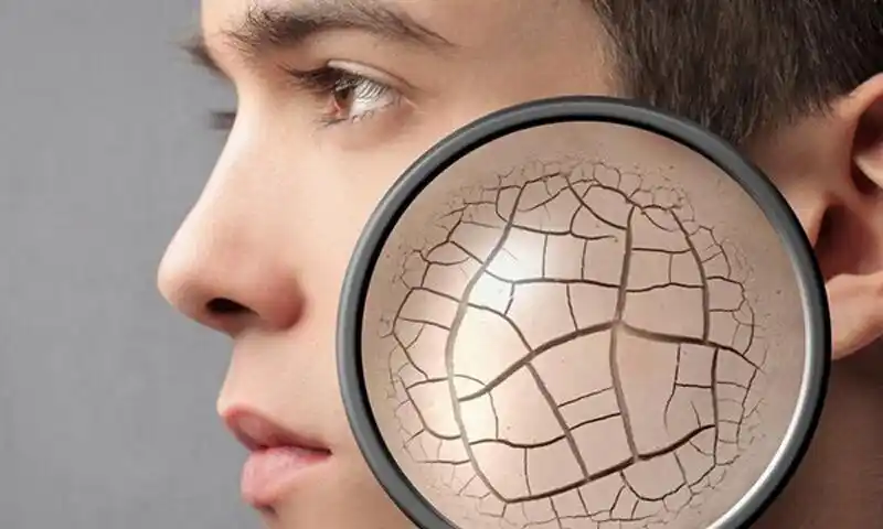 脂肪过多让肌肤干燥 男人护肤的要点