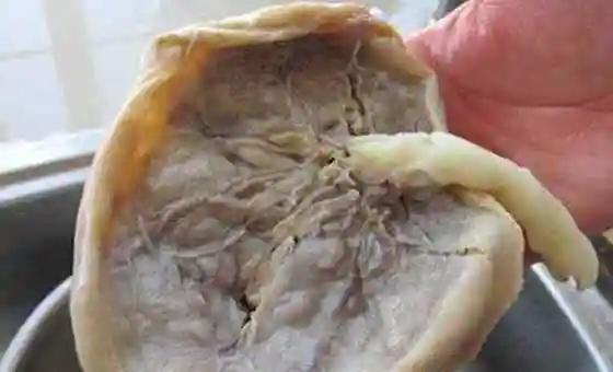 吃胎盘的禁忌 胎盘怎么处理最好 医生偷偷告诉你那些不为人知的秘密