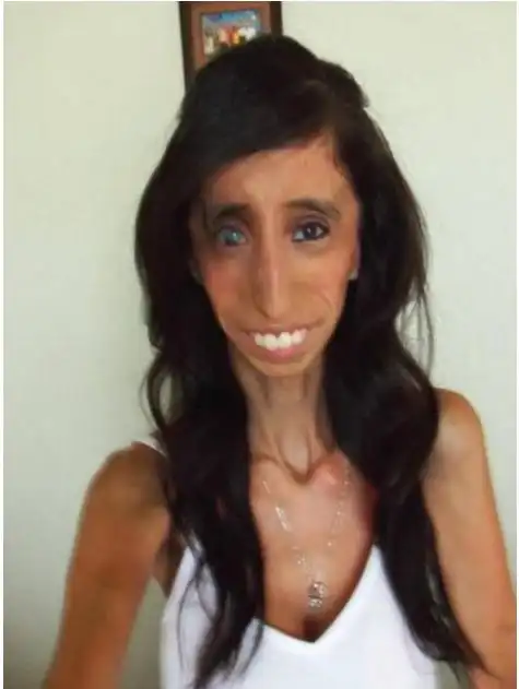 世界上最丑的女孩优质