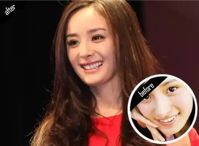 真的!杨幂,范冰冰笑着告诉你,好好保护它就能多买好几个lv!