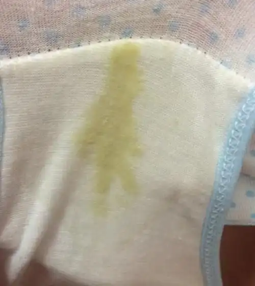 4岁小姑娘内裤上有黄褐色分泌物,诊断后大夫斥责,怎么当妈的?