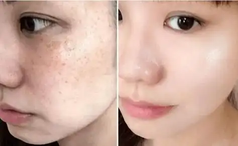 十大美白祛斑排行榜,高质量精华盘点,新手小白快来看