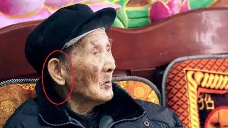 耳朵大的人更长寿,有没有科学依据呢?老中医给的答案出乎意料