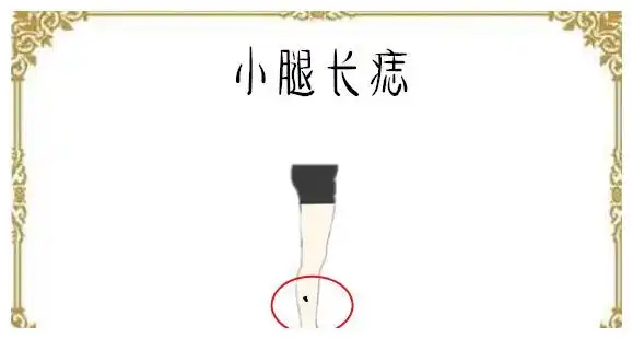 小腿长痣一个人的小腿的位置处长有吉痣,而且小腿看起来紧而有力,则