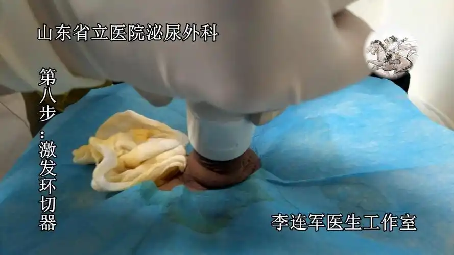 李连军-单人包皮环切器手术视频(通俗版)_20190902111914.jpg