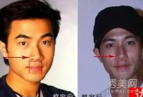 国内资讯 >> 正文 专题:娱乐圈明星毁容整容    人红是非多,刘恺威与