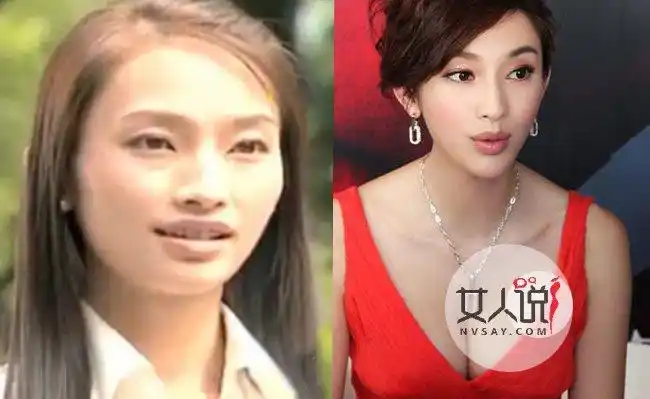 张俪整容前后照片曝光 张俪整容前长这样网友直呼辣眼睛