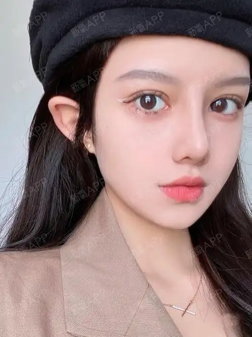 做完平扇双眼皮5个月了,还算成功吗