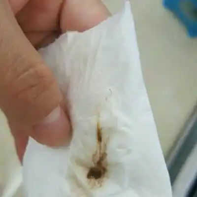 我怀孕33天今天有这样褐色分泌物!是流产徵兆嘛