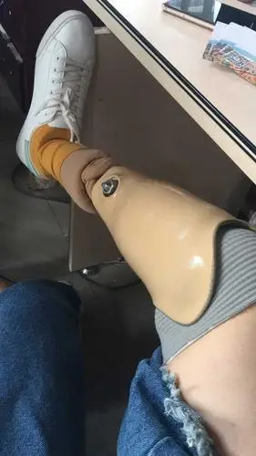 这是小腿,大腿没有拍.而且还要穿一个不透气的硅胶套.