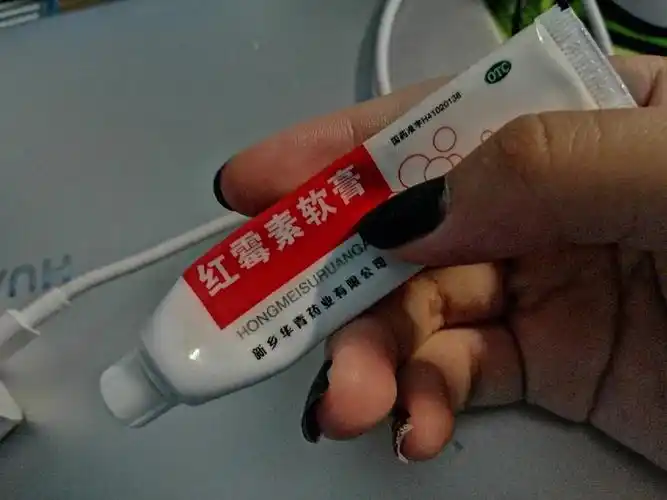 红霉素软膏巨好用!