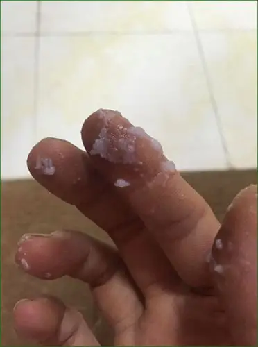 豆腐渣白带 (33)