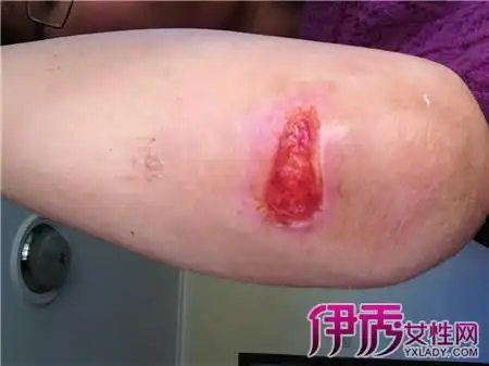 5个处理方法帮助你