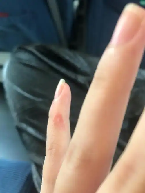 各位看看自己的左手右手小拇指