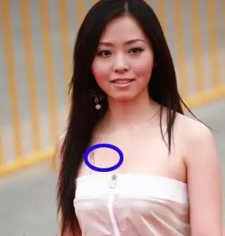 那些胸怀大痣的美女明星