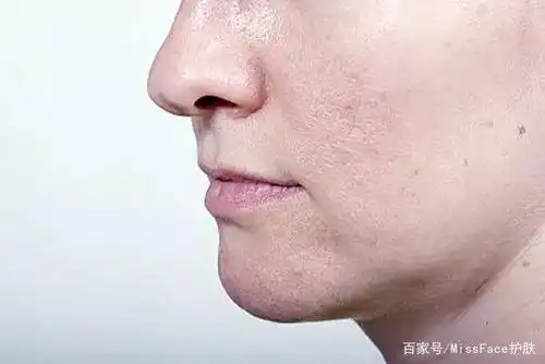 常见的肌肤问题都有哪些?这些简单的处理方法你一定要知道!