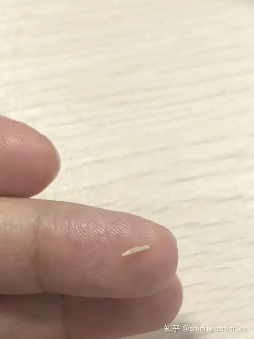 头皮拔出来这个,是啥?