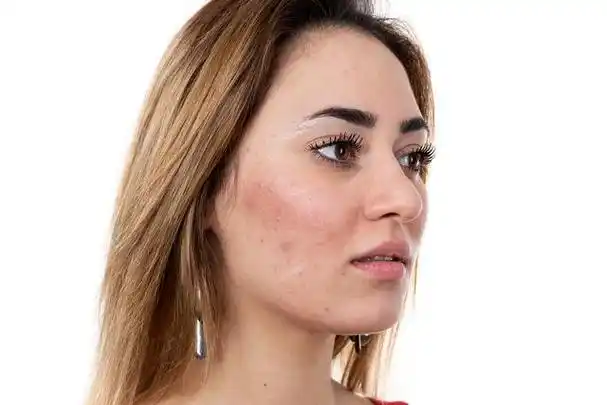 改善防晒手臂肤色,让你拥有美美的臂弯线