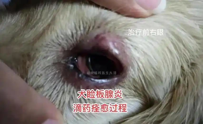 睑板腺炎是眼睑腺体 - 抖音