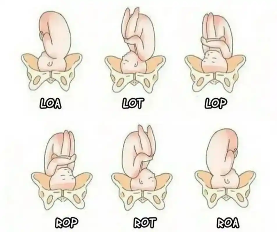一图看懂胎方位 胎方位是指先露部的指示点与产妇骨盆的关系.指示点: