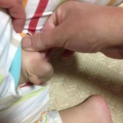 亲们,昨天给儿子洗澡,突然发现儿子泡泡多了一个软