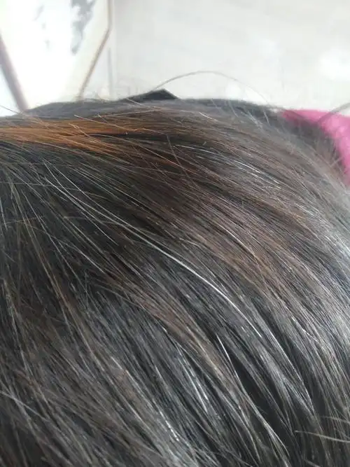 请教,女性四十岁头发白了一半,是怎么回事?