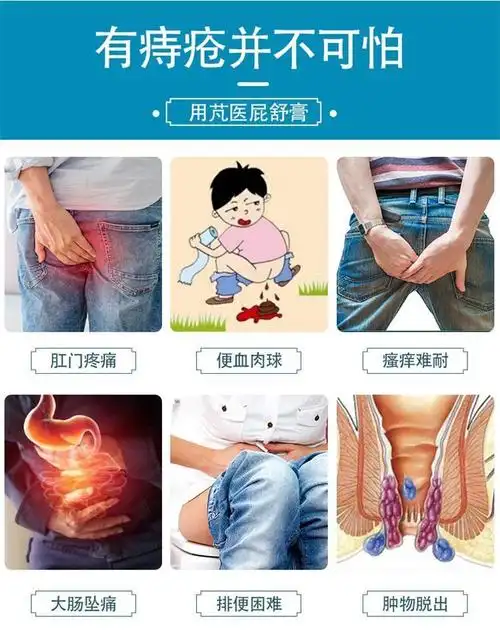 芃医草本屁舒膏球痔苍疮膏肛门球软内外屁屁舒肛周瘙痒芃医草本屁舒膏