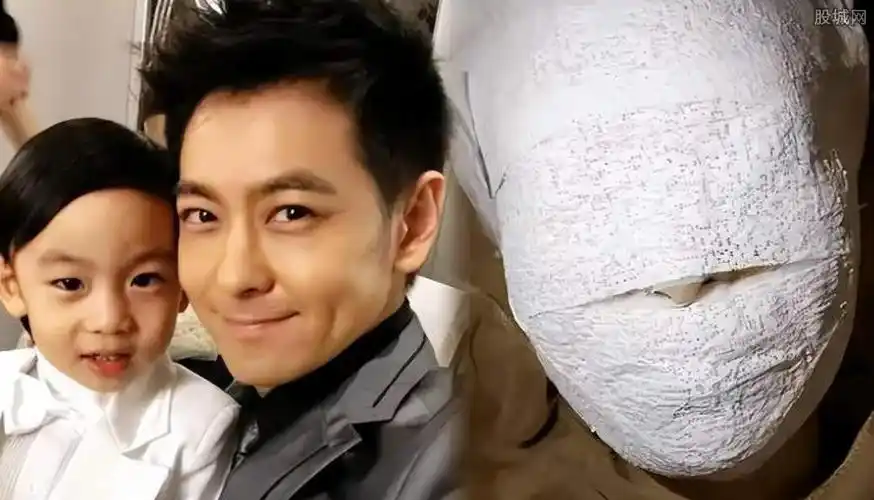 林志颖面部图片 65岁年龄的林志颖身高多少