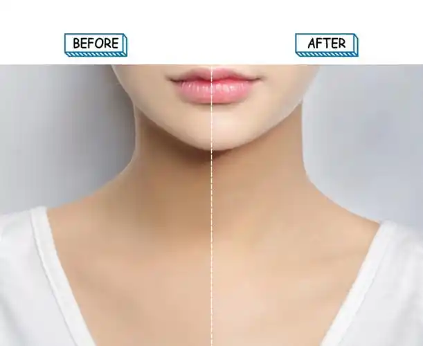 韩妞大推的嫩白面霜让你一擦就变白啊!