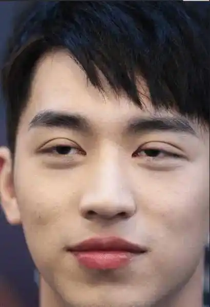 因为家族遗传的上眼睑提肌无力导致视线受阻,许魏洲就跑去割了个双