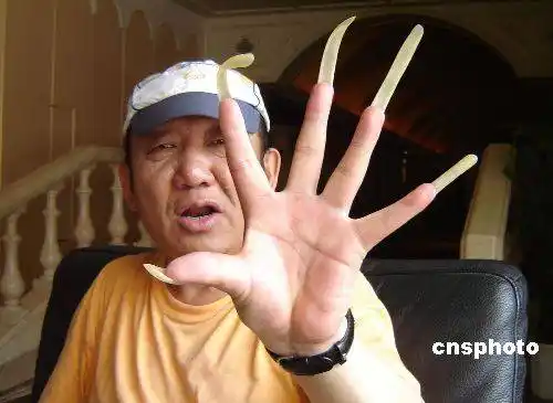 吉林一男子留指甲成癖最长8厘米图