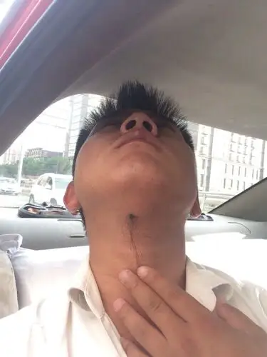 还长毛恶心死了,我想剪掉但是家人说剪了对我不好,到底?