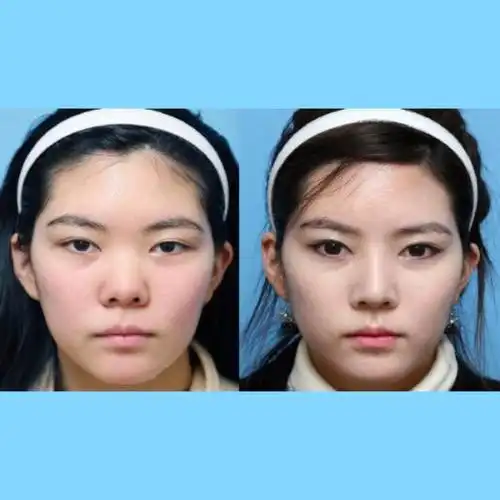 949494拥有高挺俏鼻是众多塌鼻子星人的梦想,美丽的鼻_圈子