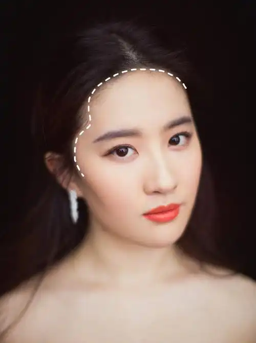 好看的发际线有哪些标准