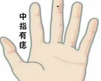 五根手指的桃花痣桃花朵朵开看看你的手指吧